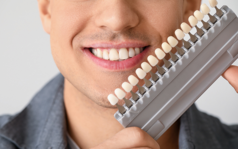 Man smiling while holding a dental shade guide showing tooth color options for veneers.