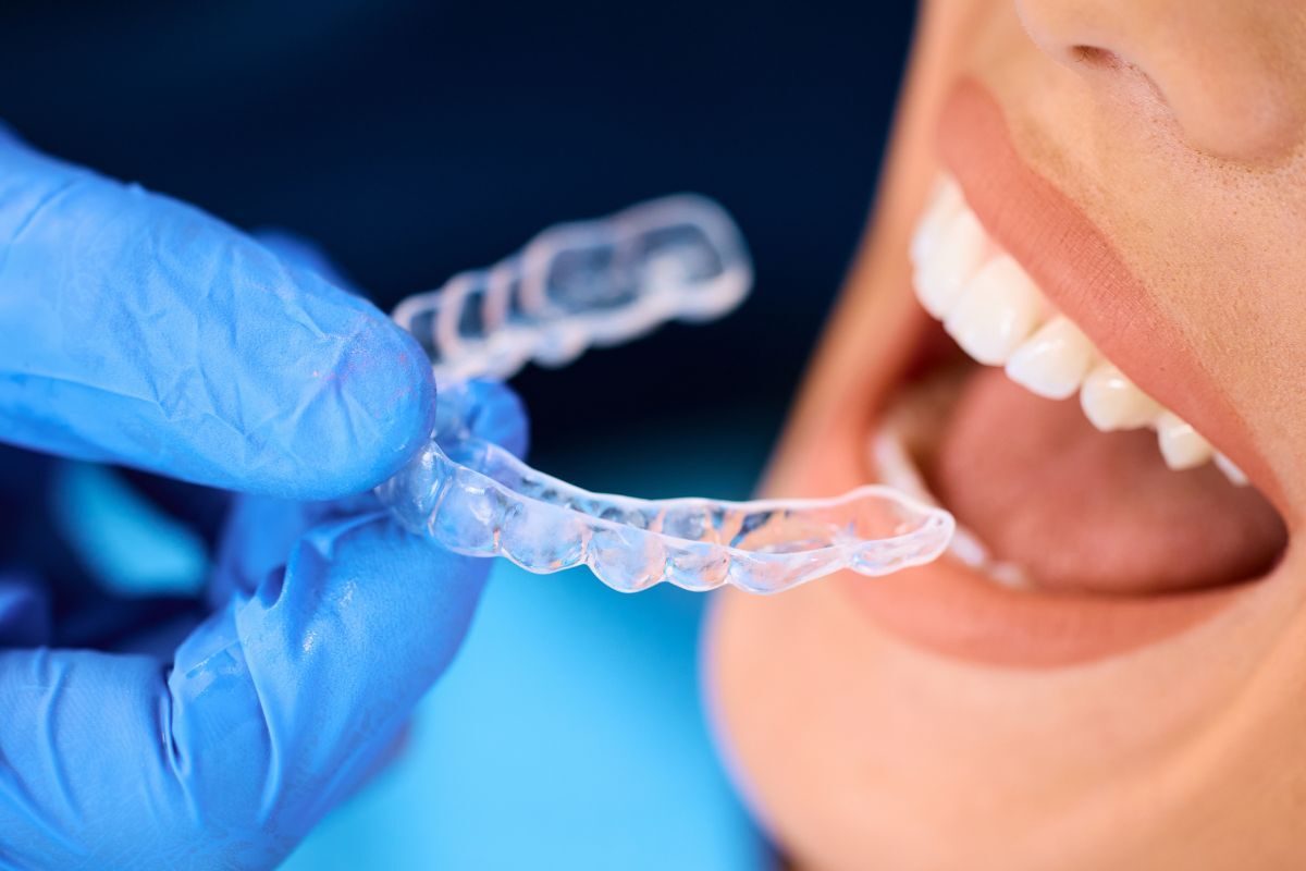 Dentist holding clear Invisalign aligner near patient's smiling teeth for orthodontic treatment.
