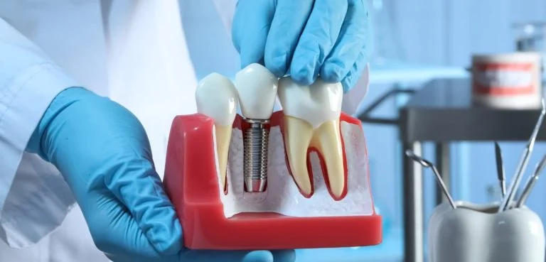 Gloved hands holding a dental model next to dental instruments