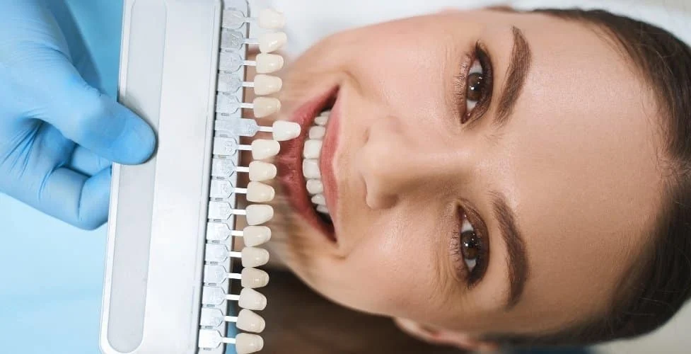 Veneers for Discolored Teeth: Can They Help Achieve a Whiter Smile?