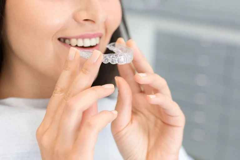 Woman placing a clear aligner on her teeth